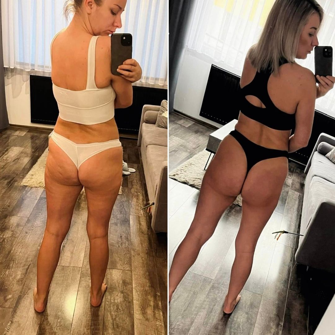 Metamorfoza Magda